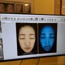 수원 영통피부관리 애띠애, 골근동안 얼굴경락 받은 후기