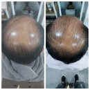 창원 두피케어를 책임지는 닥터시스셀클럽 자은점 다녀온 이야기