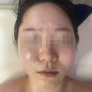 배방한라비발디아파트경로당 | [아산 배방 윤곽관리 추천] 포유에스테틱 후기 : 얼굴라인·승모근·두피까지 관리받은 배방 에스테틱...