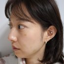 압구정로데오피부과에서 쥬베룩 스킨부스터 얼굴 전체 받아본 후기(손주사)