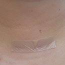 의료법인 은성의료재단 좋은강안병원 | 좋은강안병원 갑상선암수술 후 두번째 외래