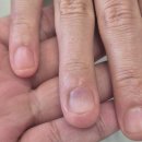 레푸스선릉점 인디고네일 | 선릉 네일샵, 네일 손 뜯는 버릇 고치기