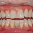 나비치과기공소 이미지