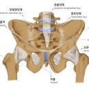 골반통 이미지