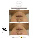 일비스파 | 1인 피부샵 일비스파 체험후기