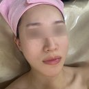 나니뷰티 | 전주 효자동 윤곽관리 &amp; 피부관리 전문샵 ‘뷰티나니’ 방문후기