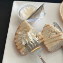 세븐일레븐 제주사대부고점 | 전북대학교 뇌동맥류 조영술, 코일색전술