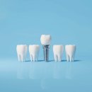 바른웅치과의원 이미지