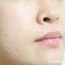 바이퓨어 이미지