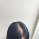 인하대역(7번출구)(37091) | 인천 학익동 속눈썹, 빈 두피커버 잘하는곳 (인하대역 7번출구)