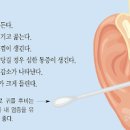 귀통증 외이도염 초기 이미지