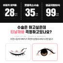 리매몰