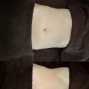 도봉구피부관리 해피트리뷰티샵에서 비만관리하고 허리 홀쭉해진 후기