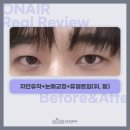 온에어성형외과의원 이미지