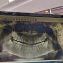 청라아트치과의원 | 청라아트치과 후기!!