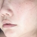 포이테니스장 | 운정에스테틱 추천, 마린트리플솔루션 광채 피부관리 직접 받아본 후기