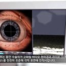 세란안과의원 이미지