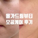 흥덕1로 79번길1R | 광교피부관리 올가드림뷰티 흥덕마을점 모공청소 디톡스 케어 후기