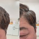 오븐마루수완1호점 | 광주장덕동미용실 리헤어살롱 옆머리, 윗머리 다 뜨는 중년 남성 전체 다운펌으로 해결