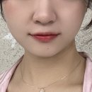 강한피부과의원 | 성수역피부과 추천 건대온다리프팅 밴스의원 성수점