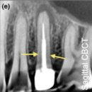 현대방사선기계 | 달서구 신경치료 이후에도 통증이 있는 이유는