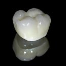 사랑치과기공소 이미지