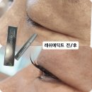 속눈썹하리