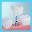 허정치과의원 이미지