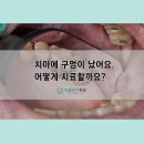 양플란트치과의원 이미지