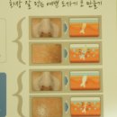 미소스킨 이미지