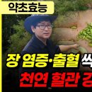 장 염증·출혈 싹 잡아주는 천연 혈관 강화제 이미지