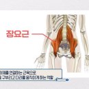 척추운동공간 이미지