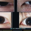 부천안과