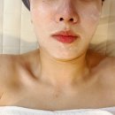 금광동피부샵 성남피부관리 물광관리 봄봄고운피부