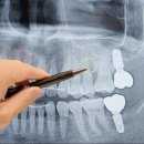 매직치과기공소 이미지