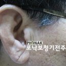 포낙보청기음성센터