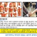 종부테라피 이미지
