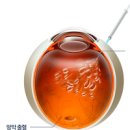 황반변성 초기증상 주사 치료 예방법 정리 이미지