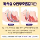 질병 "수면 무호흡증 Sleep apnea" 이미지