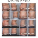 울트라쉿 네이버블로그
