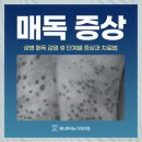 제니트비뇨기과의원 | 천호동비뇨기과 매독 증상 잠복기 빠른 치료 중요한 이유