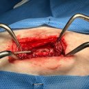 TL 동물병원 | 강아지 디스크 수술 후기: T12–13 척수 압박 IVDD 수술로 보행 회복한 실제 사례