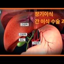 장기 이식 검사[tests for organ transplantation] 이미지