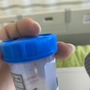 신이비인후과의원 - 안양시 만안구 안양로 282 | 침샘 타석증 수술 후기 - 증상, 비용, 실비 보험 청구 팁 총정리