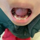 키즈프라임치과의원 | [관저동 키즈치과] 관저키즈치과 다녀온 후기｜아이랑 가기 편한 치과 추천