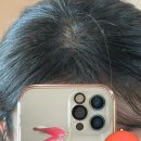 스트레스&amp;다이어트로 인한 탈모 극복기 / 여성탈모영양제•여성탈모약•탈모두피에센스•내돈내산...