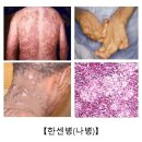 일원역1번출구약국 네이버블로그