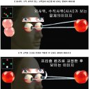 이태리 안경원 | 이영양증 질환 고객 “프리즘 안경” 제작기 - 강서구 사시교정 - 목동 잠복사시 교정 - 비엔나 안경원 -