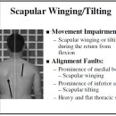 Scapular Winging and Tilting의 치료 이미지