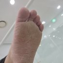 골든메디 | 대전 갈마동 발각질 제거 가장 만족스러웠던 골든풋 대전점 페디쿱스